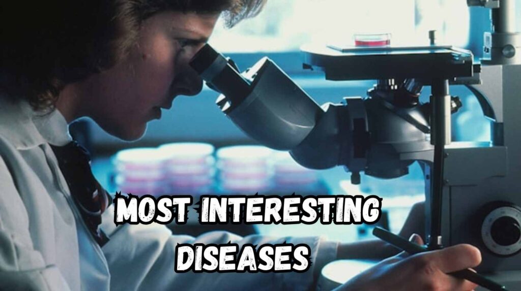 most interesting diseases