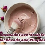 homemade face mask for blackheads and pimples