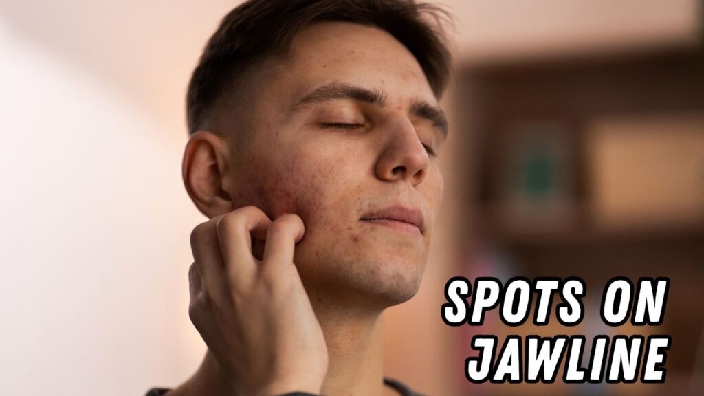 spots on jawline