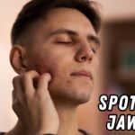 spots on jawline