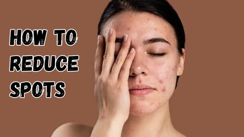how to reduce spots
