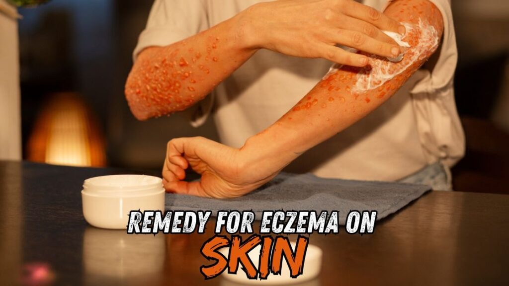remedy for eczema on skin