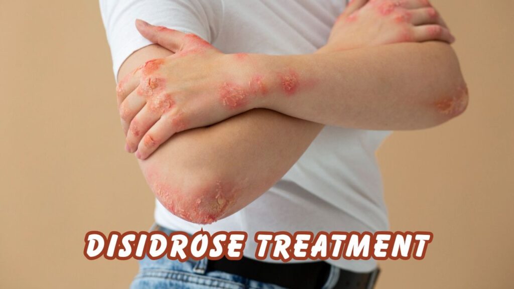 disidrose treatment