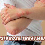 disidrose treatment