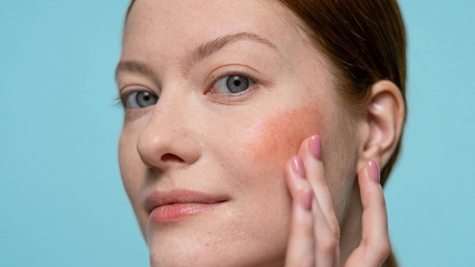 dull skin